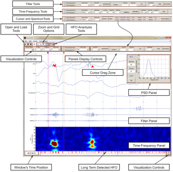 Ripplelab - A MATLAB tool for detection of brain High Frequency Oscillations