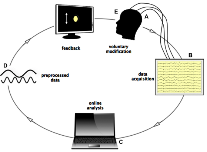 Neurofeedback